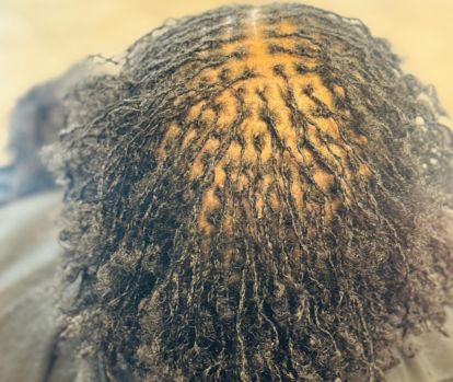 Micro Locs
